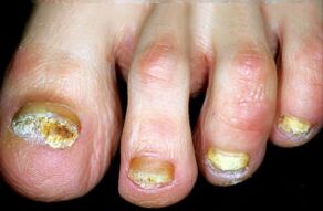 Karakterizacija bolesti