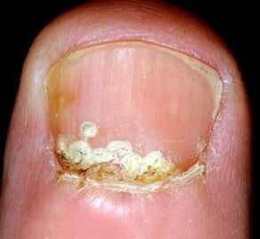 Simptomi i znakovi bolesti