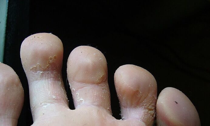 početni stadij gljivica